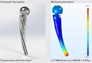 MRI Heating Simulation of Hip Implant