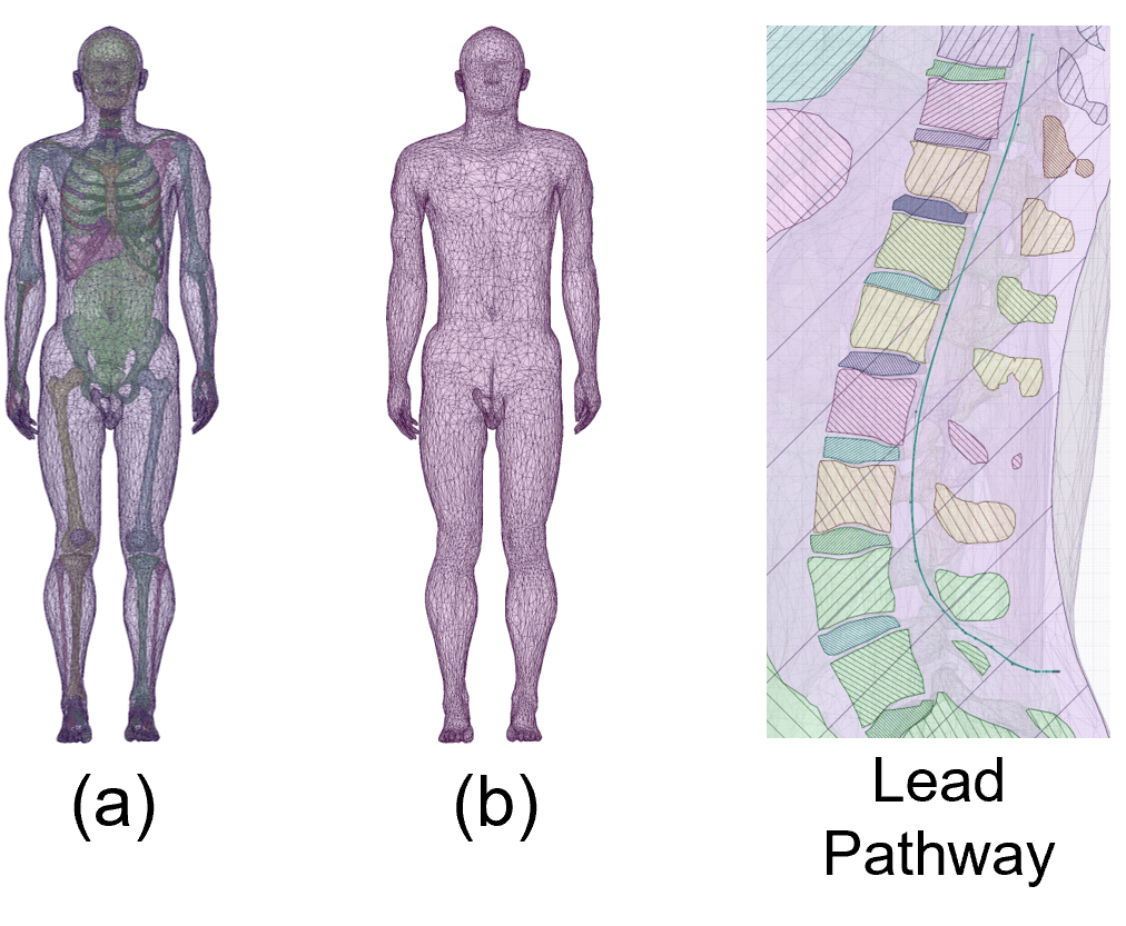 RF-Induced Heating of AIMDs, Radiofrequency-Induced Heating of Active Implantable Medical Devices